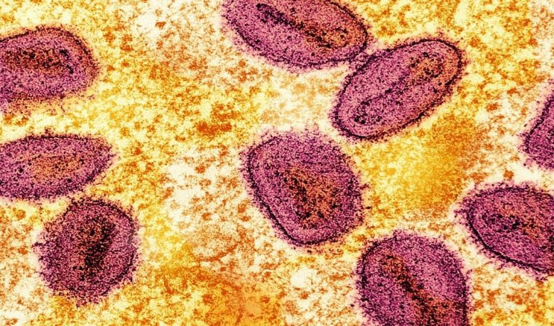 Pecah Rekor – Kasus Pertama Flu Burung Strain H5 Ditemukan di Australia, Diduga dari Burung Laut