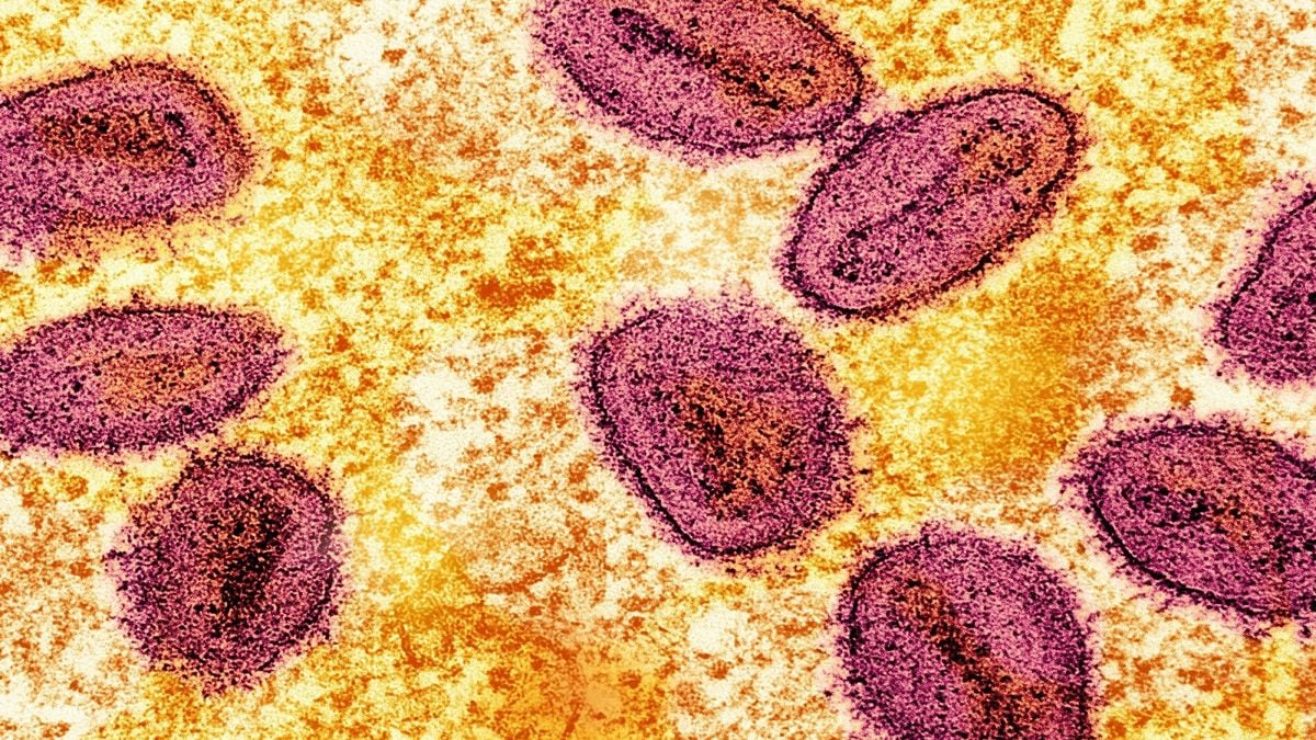 Pecah Rekor – Kasus Pertama Flu Burung Strain H5 Ditemukan di Australia, Diduga dari Burung Laut